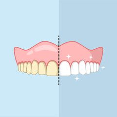 Clean and dirty teeth, whiten or clean teeth illustration