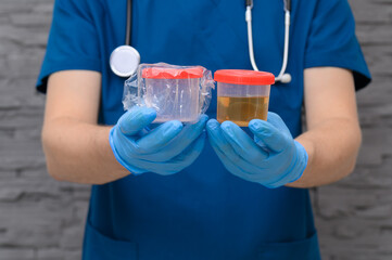 Plastikowe pojemniki na próbki moczu, lekarz prowadzący badania i diagnostykę pacjenta 
