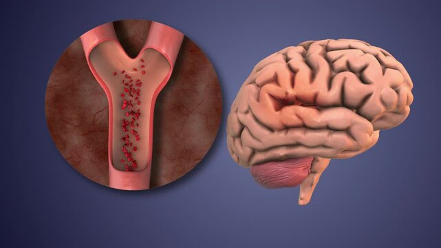 Recombinant Therapy for Breaking Down Blood Clots