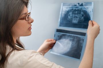 Female dentist uses X-ray to monitor treatment progress and prevent complications in dental care.