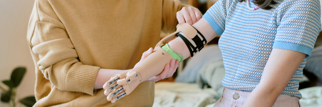 Female having prosthetic arm fitted by another person in relaxed, indoor setting with soft lighting and calm environment