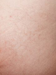 A detailed close-up of human skin with fine hair, emphasizing texture and natural imperfections.
