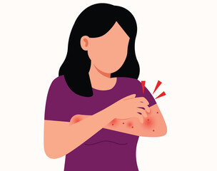woman scratching arm. Female suffering from strong allergy Red rash skin irritation. 
