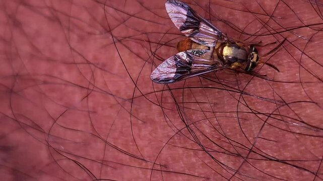 Macro Video of Dangerous fly Sucking Blood from human skin, Dengue Disease, Zika, EEE Virus Parasite Insect Bite