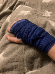 verletzung hand verband gips