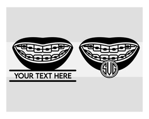 Fake Braces, Fake Braces Kit, Fake Braces Clip On, Braces Svg, Dental Braces For Kids, Braces Clipart, Teeth Svg, Braces Silhouette, Dentist, Dental Hygienist, Braces Outline, Eps, Cut file