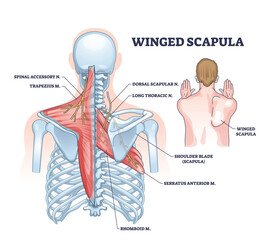 Winged scapula diagram shows shoulder blade protrusion, highlighting muscles and nerves. Outline diagram