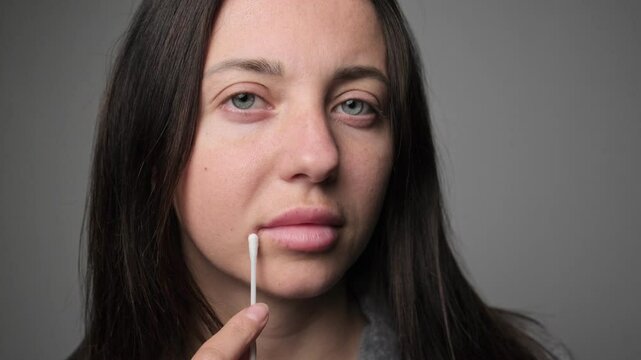 Close-up of a woman points a cotton swab to a cold sore on her lip, indicating treatment or care for a possible herpes simplex virus infection.
