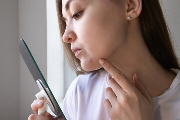 Young woman looking at her acne in mirror, touching pimple on her face. Concept of breakouts,...