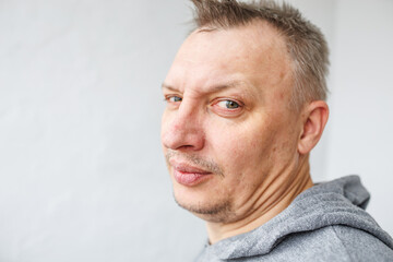 Obraz premium face of angry person dissatisfied with life and everything that happens. man is grimacing