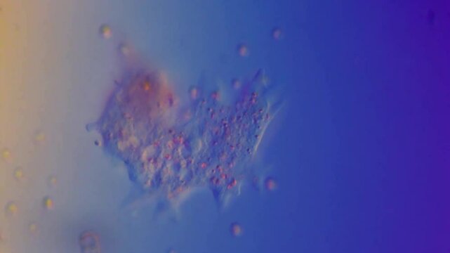 Amoeba motility using pseudopods-400x DIC microscope differential interference contrast microscopic  observation aquatic protists water microbiology