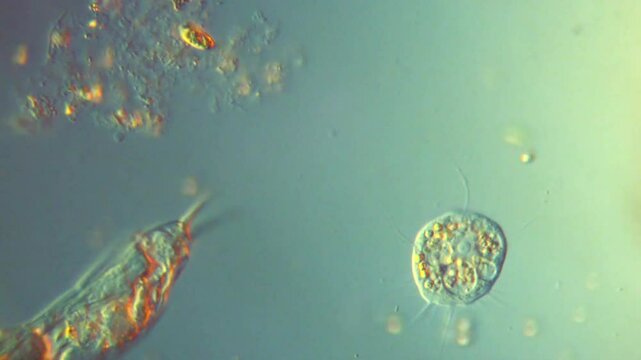 Rotifer Vampyrella vampire amoeba -400x DIC Microscope differential interference contrast microscopic footage of aquatic protozoa