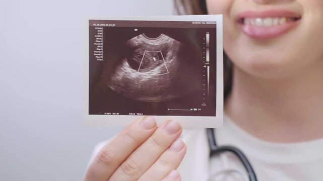 Obstetrician-gynecologist working with a patient, analyzing ultrasound images to ensure healthy and safe conception.