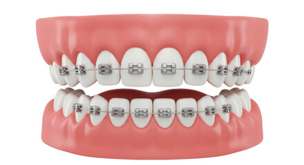 Isolated Teeth with Braces