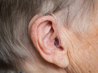 Close-up of an elderly woman’s ear with a hearing aid, symbolizing age-related hearing loss, assistive technology, and senior healthcare.