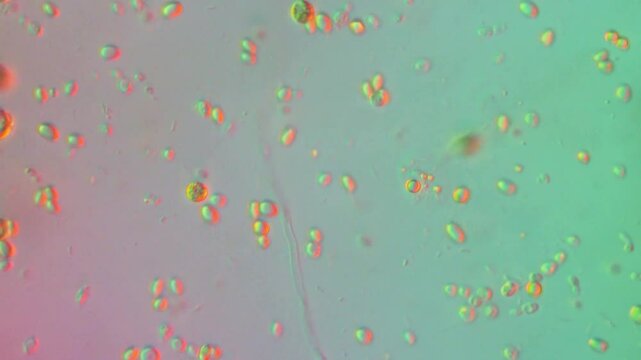 Freshwater Algae Bloom-DIC microscope 400x magnification, high contrast microscope of photosynthetic single celled organisms 