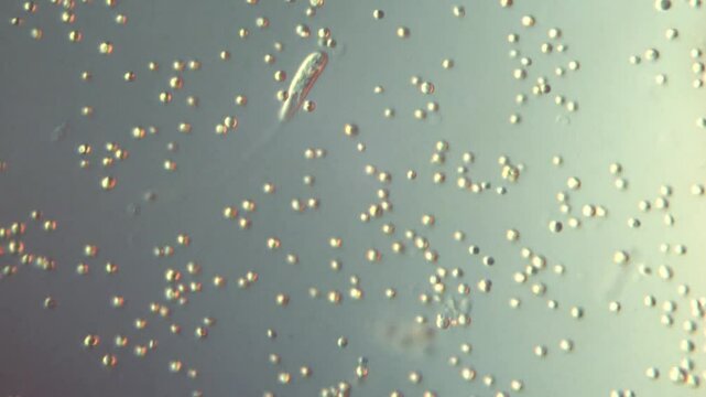 Peranema sp. flagellate swims in algae bloom-400x magnification DIC microscope, differential interference contrast microscopic slide of pond eukaryotic cells, microscopic life of microorganisms