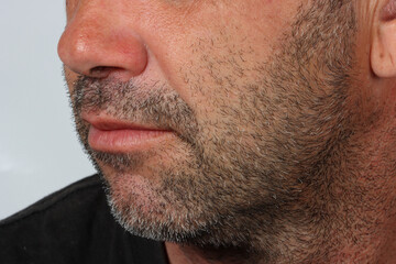 Lower face of a 45-year-old man with light stubble, showing natural facial texture