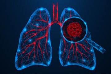 Human lung cancer under a magnifying glass. Polygonal design of interconnected lines and dots. Blue background.