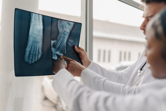 Doctors examining foot x ray for potential injury diagnosis