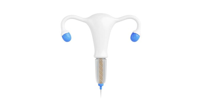4k Resolution Video: Birth Control Concept. Futuristic Concept of T Shape IUD Copper Intrauterine Device of the Future Seamless Looped Rotating on a white background with Alpha Matte