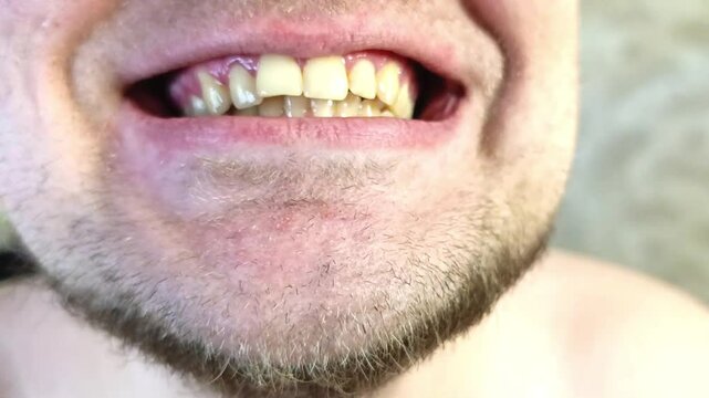 A close-up shot depicts a mans mouth open revealing yellow teeth and a short goatee. The image focuses on dental appearance.