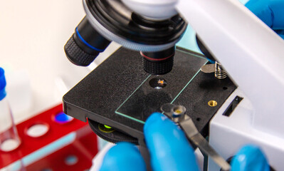 Tick in a test tube in the laboratory. Selective focus.