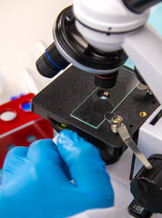 Tick in a test tube in the laboratory. Selective focus.