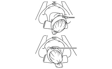 Neck Traction Exercise Step-by-Step Illustration – Physical Therapy Stretch for Neck Pain Relief