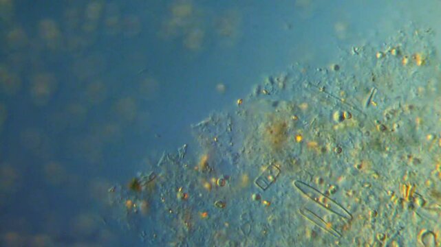 Bacterial life in freshwater sediment captured under DIC microscope - Water microbiology differential interference contrast microscope