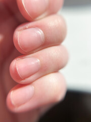 A close-up captures the delicate structure of a hand with natural, unpolished fingernails. The skin appears smooth and healthy, illuminated by soft, bright light.