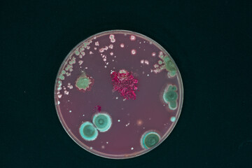 Petri dish with bacteria