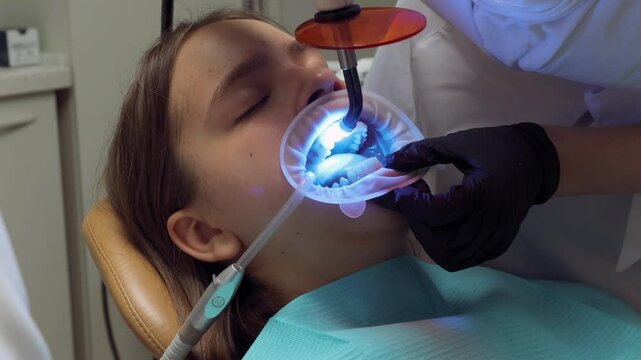A close-up of a dental procedure where a dentist uses a UV curing light to harden adhesive on a patients teeth, part of the preparation process for applying clear aligners in an orthodontic treatment