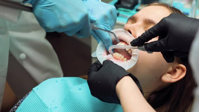 A teenage girl receives dental treatment as a team of professionals use suction and water spray to rinse the teeth, preparing for aligner bonding during an orthodontic procedure in a clinic