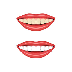 Fototapeta premium Comparison of yellow and white teeth before and after whitening treatment vector illustration, dental health improvement, oral hygiene care, aesthetic transformation for a confident and radiant smile.