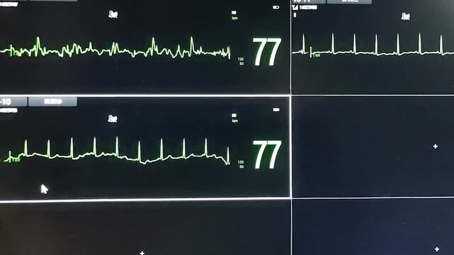 Various graphics and data on the monitor