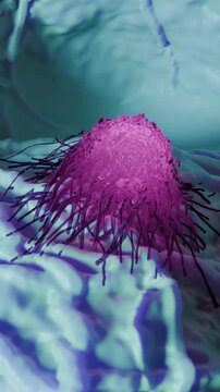 A tumor is an abnormal mass of tissue that can be benign (non-cancerous) or malignant (cancerous). A cancer cell is a cell within a malignant tumor that exhibits uncontrolled growth