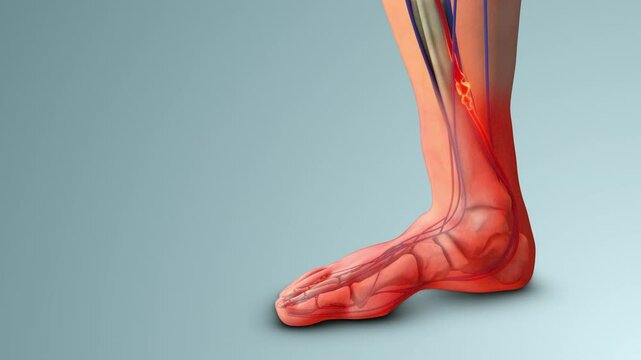 Leg Swelling and Pain from Vein Thrombosis