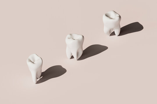 3D render of three molar teeth in a diagonal alignment