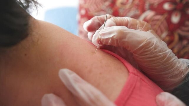 Manipulation of a dry needling needle on a patient, treatment for muscle pain relief, use of gloves in a health procedure