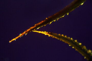 Micrograph of serrate moss leaf tips with polarization at 40x.