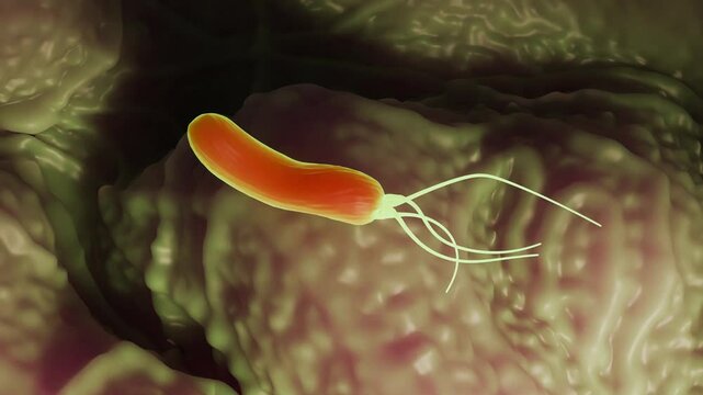 Helicobacter pylori bacteria, is a gram-negative, flagellated, helical bacterium. Mutants can have a rod or curved rod shape that exhibits less virulence