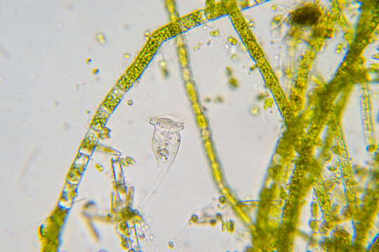 Protozoa vorticella in water