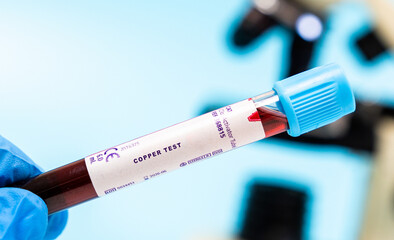 Obraz premium Assesses copper levels, necessary for iron metabolism and
