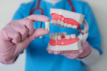 Dentist holds tooth. Ceramic veneers teeth or extraction. Dental implantation prosthetics. Painless...