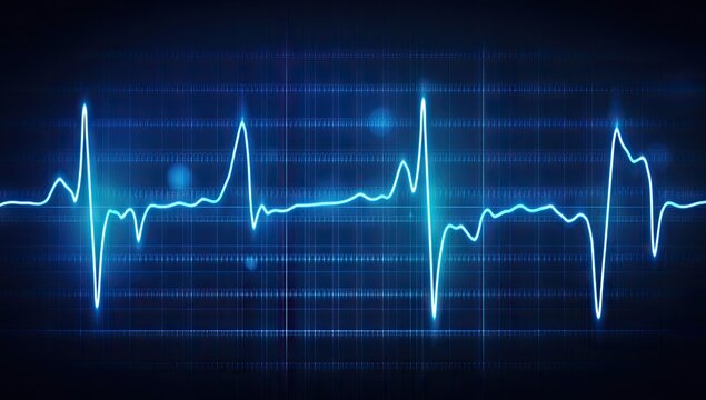 EKG graphic showing a healthy heartbeat