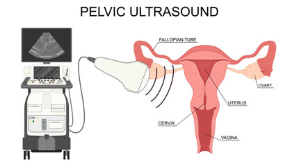 Pelvic ultrasound. Transabdominal Ultrasound Examination of the Uterus and Ovaries.