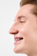 Obraz premium A close-up view of a cheerful young adult with orthodontic braces on their teeth. The persons skin is clear, and they have a content expression on their face, their eyes gently squinting as they smile