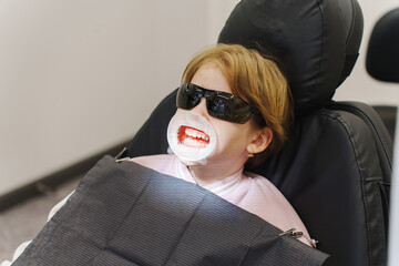 A child is receiving dental hygiene care in a clinic. The child wears sunglasses and a protective mask while a dental professional attends to their oral health, ensuring comfort and safety.