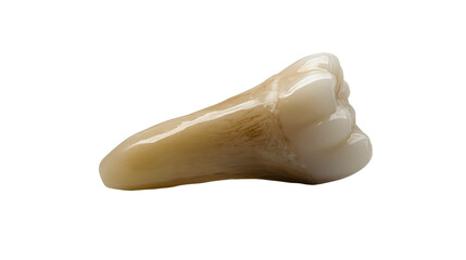 An extracted human tooth from the human jaw, a classic old human tooth with one root, showing various signs of deterioration and processes.
